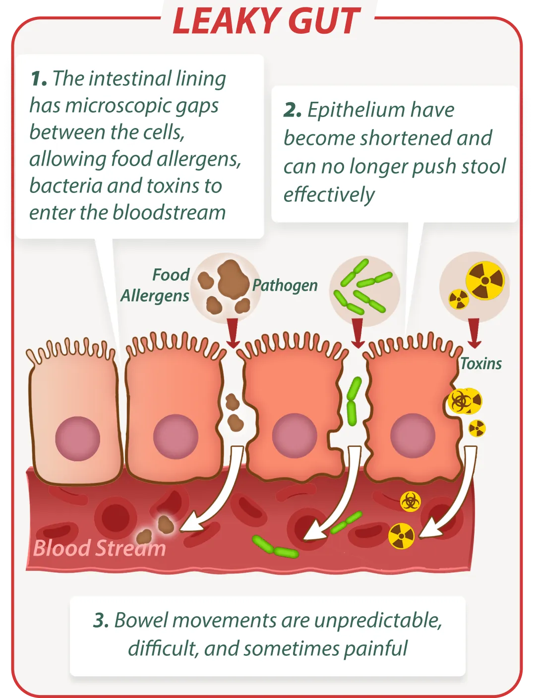 Leaky gut without Emma Relief – digestive issues illustration